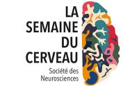 Semaine du Cerveau 2021 à Dijon : deux conférences en ligne gratuites. Du 16 au 17 mars 2021 à Dijon. Cote-dor.  12H30